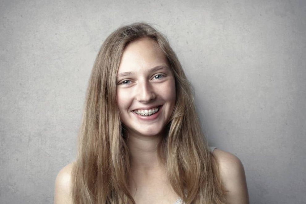 How Braces Can Help Align Your Teeth