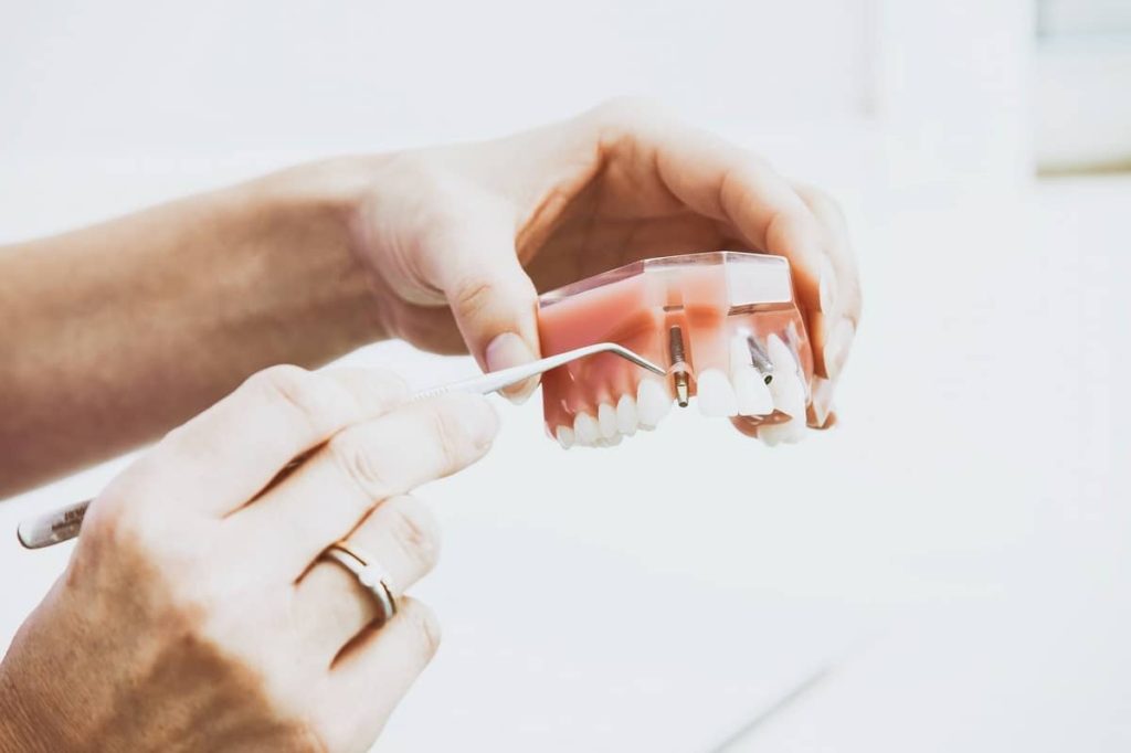 Orthodontics for adults